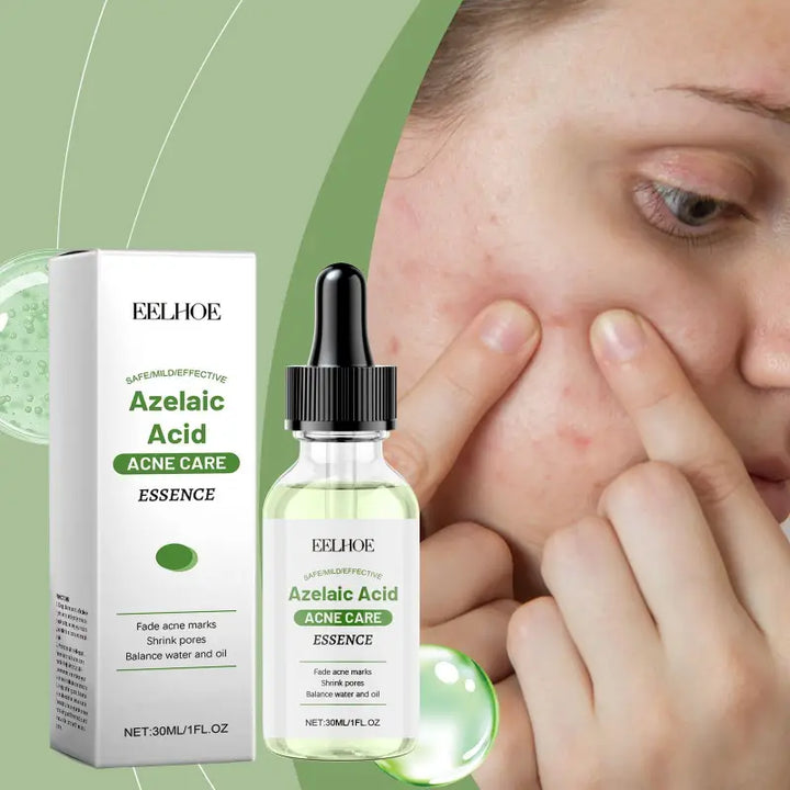 Azelaic Acid Essence for Acne Care – targeted solution for red, irritated skin, helps fade acne marks and reduce inflammation